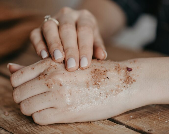 psoriasis