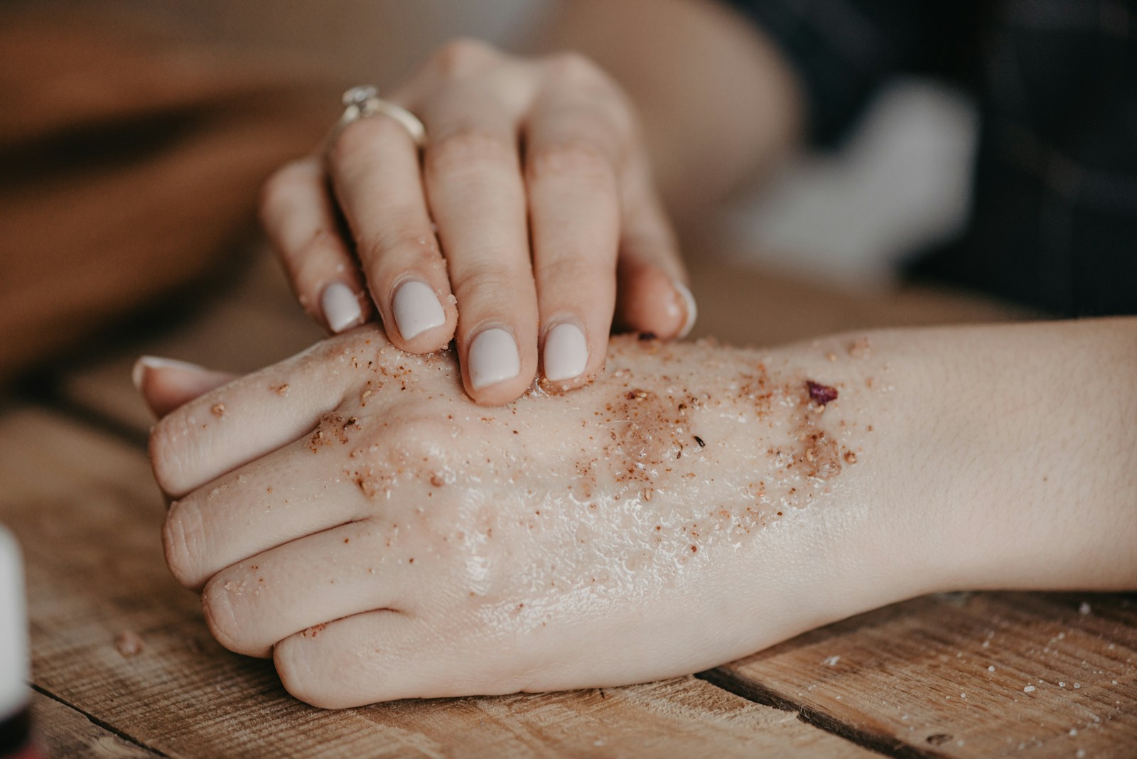 psoriasis