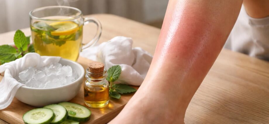 découvrez des remèdes de grand-mère étonnamment efficaces pour soulager une jambe gonflée. astuces naturelles et conseils pratiques pour retrouver confort et légèreté rapidement.