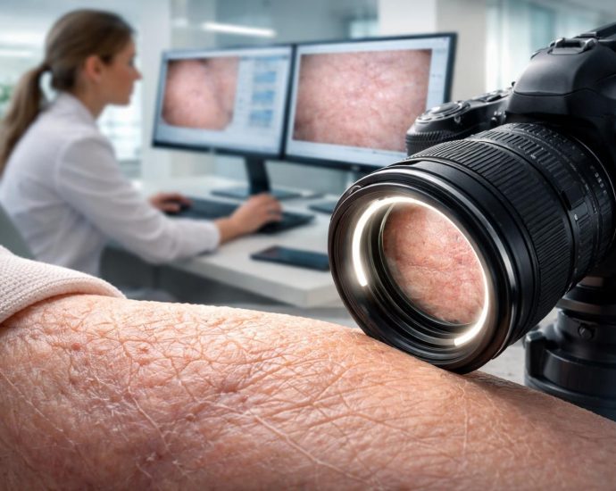 découvrez comment la photo et le traitement innovant pour la dermatoporose révolutionnent les soins cutanés en améliorant la santé et l'apparence de votre peau.